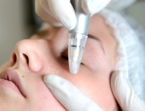 Microdermabrasion